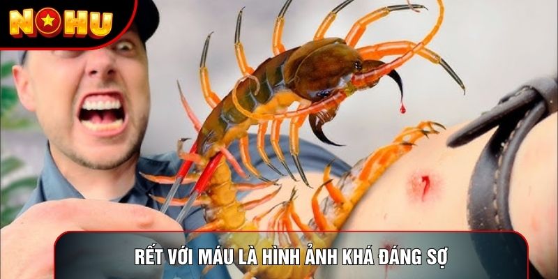 Rết với máu là hình ảnh khá đáng sợ Rết với máu là hình ảnh khá đáng sợ
